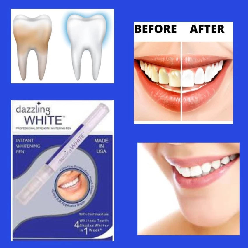 Dazzling Smile: Advanced Teeth Whitening Pen for a Brighter, Whiter Smile